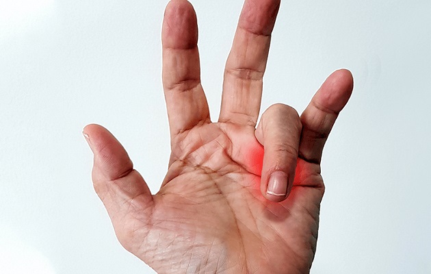 Esta afección se denomina dedo en gatillo.