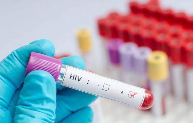 The UN sees the eradication of AIDS possible by 2030