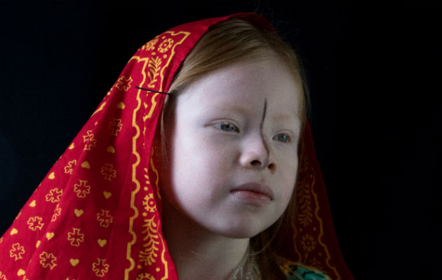Evaluarán cumplimiento de los derechos de las persona albinas en Panamá. Foto: Archivos
