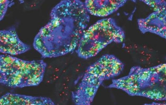 Dos de los genes -Gsta4 en rojo y Cyp4a14 en verde- que son más activos en los riñones de ratones hembra (azul). Crédito: Jing Liu/Laboratorio McMahon