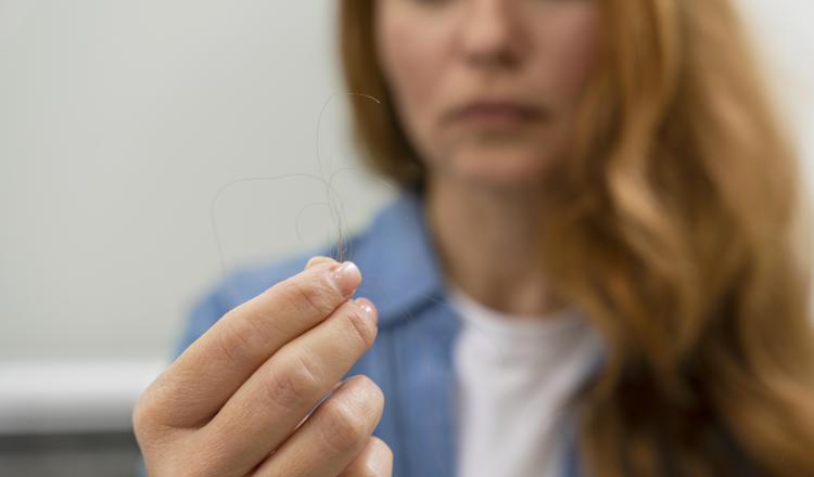 Hair loss, a problem beyond aesthetics