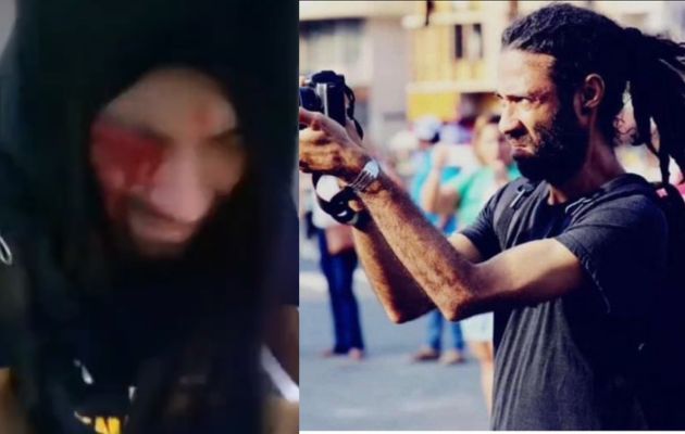 Exigen justicia en el caso de agresión del fotógrafo Aubrey Baxter. Foto: Cortesía