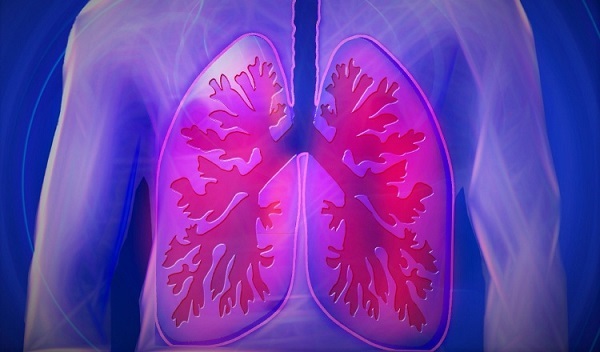 Lung cancer, for early detection