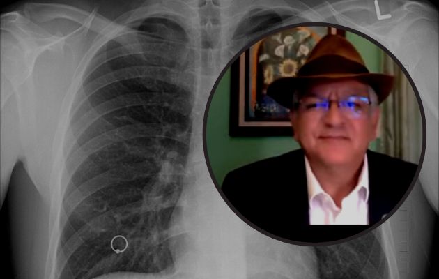 Doctor Alberto Colorado, integrante de la Coalición de TB de las Américas. Foto: Cortesía