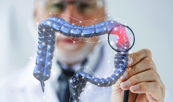 Colon cancer in young adults: what should you know?
