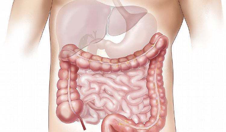 Be careful with gallstones!