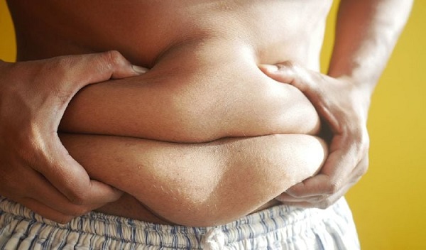 La obesidad no es falta de voluntad.  Foto: Pexels