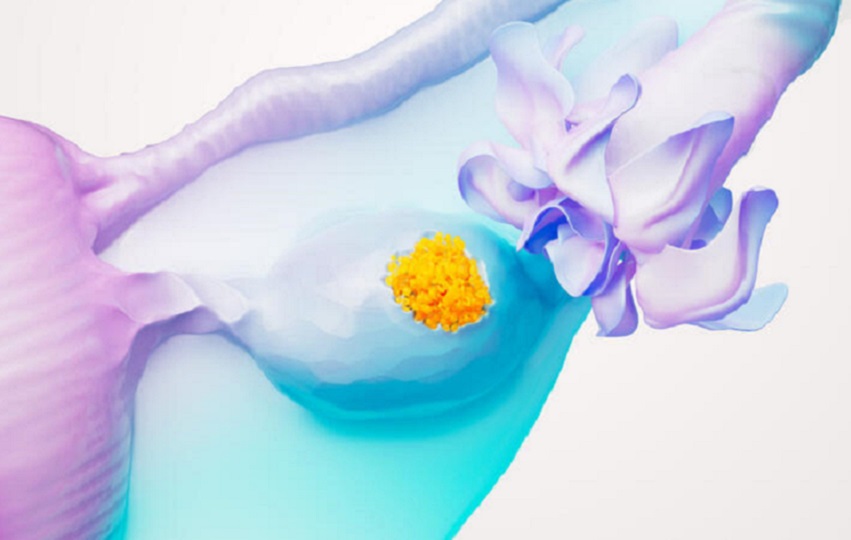 En los últimos años, el tratamiento del cáncer de ovario ha experimentado avances significativos gracias a la investigación y el desarrollo de terapias innovadoras. Cortesía