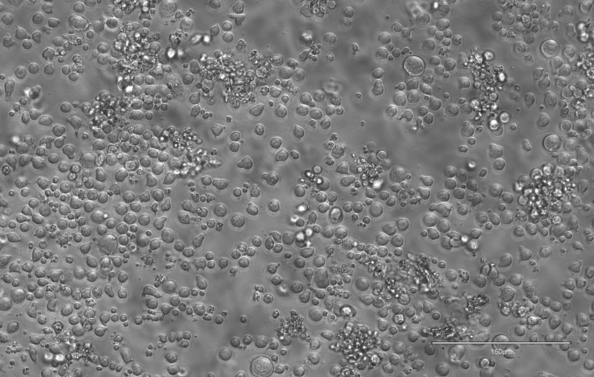 Células madre hematopoyéticas de ratón cultivadas en el día 12, lo que permite estudiar su biología en etapas muy tempranas.  Foto: EFE