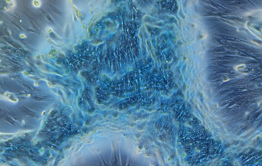 Primer lugar de FotoCiencia 2024 en la categoría Fotografía Microscópica. Foto: Rebbeca Vergara