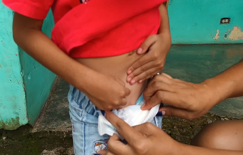 Los fármacos deben ser traídos desde Estados Unidos, ya que no se encuentran disponibles en el país. Foto. Melquíades Vásquez