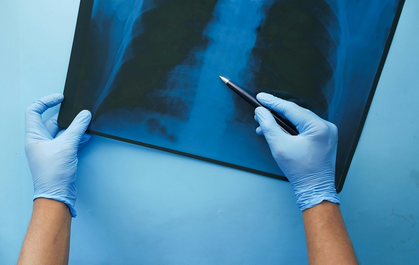 Las autoridades instan a la población a vacunarse.  Pexels