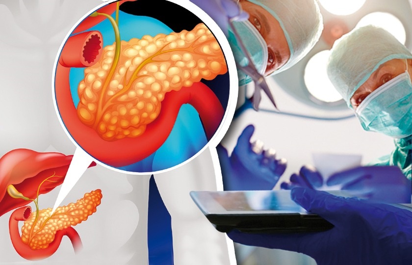 El cáncer de páncreas es muy agresivo. Foto: Ilustrativa / Freepik