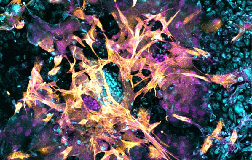 Imagen microscópica de un embrión humano de 14 días que se ha implantado en el nuevo modelo endometrial. Foto: Matteo Molè/EFE