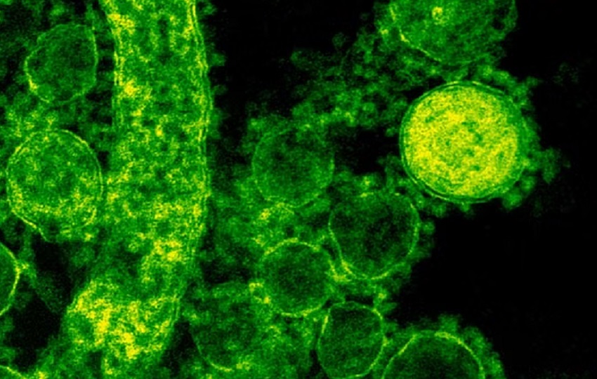 Bacteria Come carne es una infección en la sangre produce lesiones en la piel con ampollas, además de fiebre, escalofríos y presión baja.Foto: ilustrativa Bacteria Come carne es una infección en la sangre produce lesiones en la piel con ampollas, además de fiebre, escalofríos y presión baja. Foto: ilustrativa