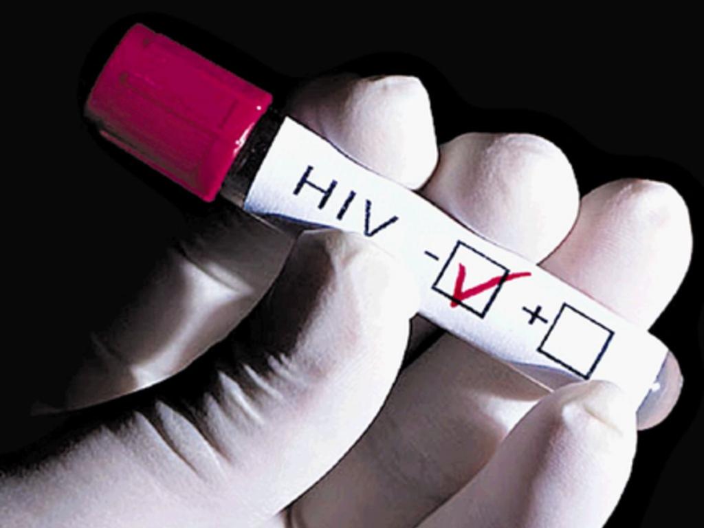 En varios países, la epidemia se está propagando en lugar de disminuir.()