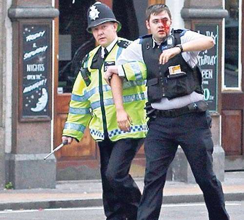 <p>Agente herido.</p>