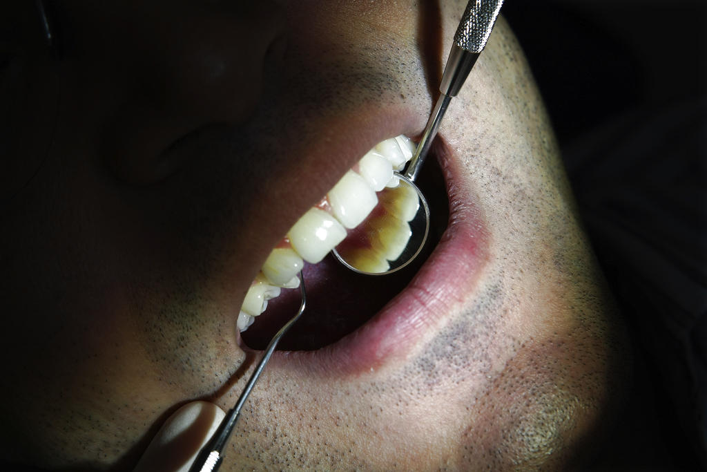 Las van deteriorando la capa superficial del diente, el esmalte, y las enfermedades periodontales deterioran los tejidos de soporte del diente.