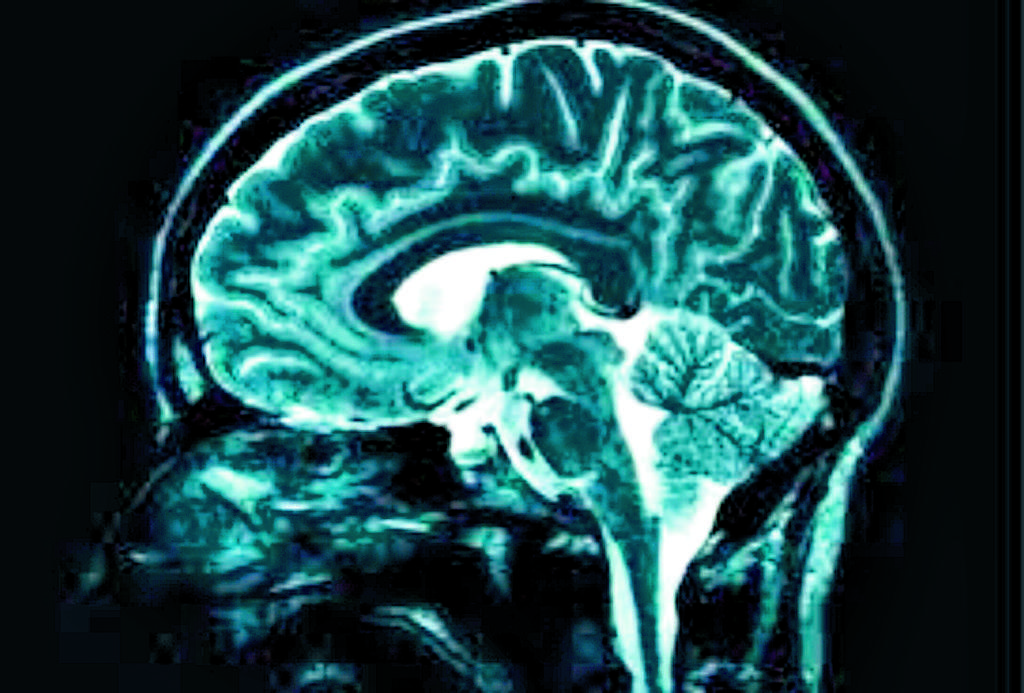 <h2>El Gobierno de Estados Unidos prepara un un mapa de la actividad del cerebro humano. Foto/Archivo.</h2>