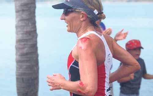 <p>Herida. Natascha Badmann sufrió un accidente.</p>