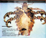 <b>Pthirus pubis</b><br>Muy común<br>Comúnmente conocido como ladilla. También parasita al ser humano, principalmente en los genitales. Su infección causa ftiarisis. Además, ocasiona prurito muy molesto que puede provocar irritación e infección en l