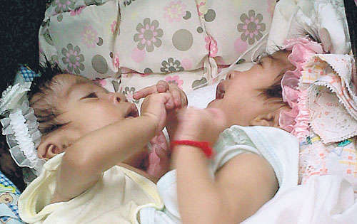 <p>Siamesas. Milagros María (derecha) y María Milagros(izq).</p>