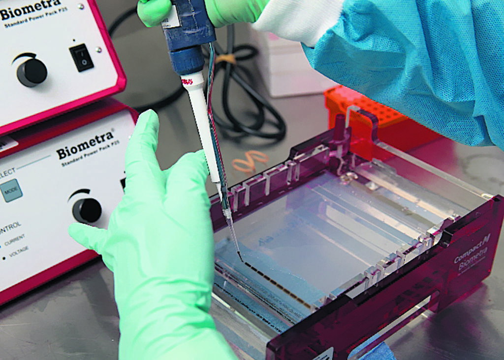 Metodología. Muestras en el gel de agarosa para la realización de la técnica electroforesis de ADN.()