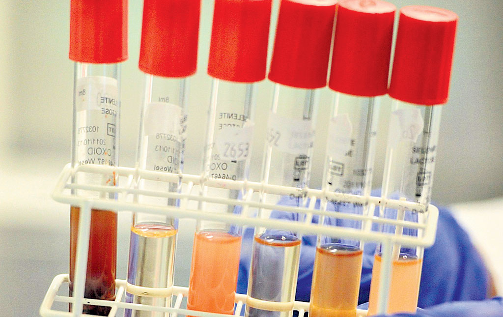 <p>Pérdida. Se convierte en un reto para la medicina.</p>