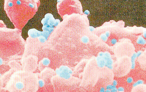 <p>Virus. Ataca a todos por igual, sin importar clase o color.</p>