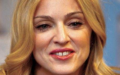 <p>Tiene los dientes separados.</p>