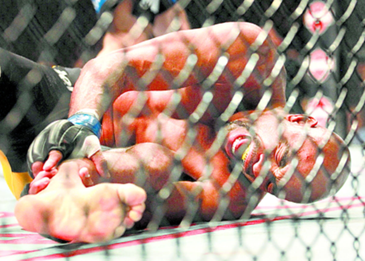 Dolor. Anderson la Araña Silva sostiene con fuerza la pierna izquierda, tras conectar una patada baja que se estrelló contra Weidman y le produjo una fractura de tibia.(AP)