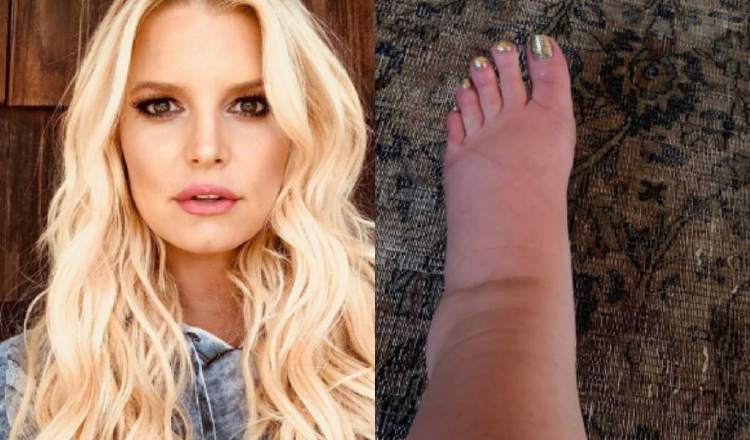 Jessica Simpson.  