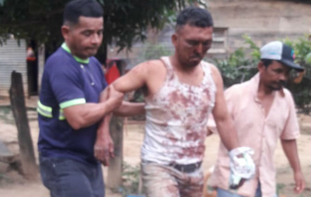El macheteado (centro) también fue brutalmente golpeado. Foto: Mayra Madrid.