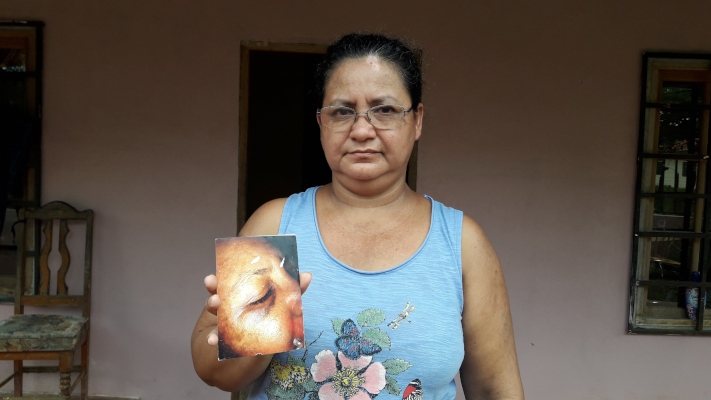 Doris Cazasola, quien fue su primera víctima hace cinco años, narró como fue atacada por este sujeto, cuando se bajó del bus en la parada, en ese momento sintió que el sujeto la golpeó, ella trató de defenderse. Foto/Mayra Madrid