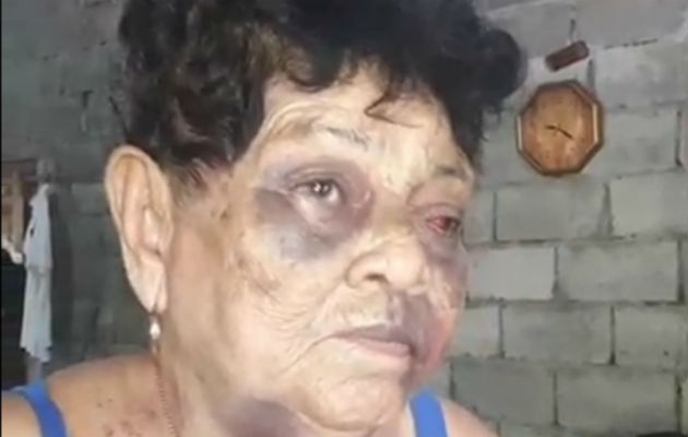 Ernestina Justavino Gutiérrez, de 88 años de edad, fue brutalmente golpeada por este sujeto. Foto: Mayra Madrid.