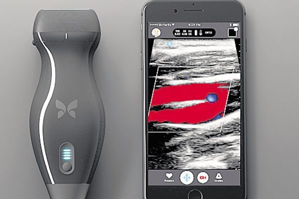 Sistema: Imagen del nuevo ecógrafo de bolsillo con los dos dispositivos acoplados.