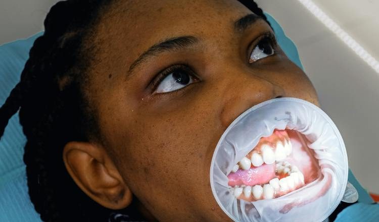 Cuidar los dientes es importante. Pexels