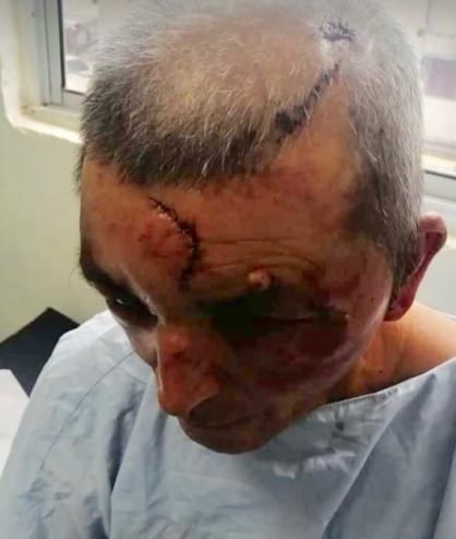 Luego de golpear brutalmente a la pareja en la cabeza y rostro se llevaron aproximadamente unos $5,000, prendas y el vehículo tipo camioneta propiedad de la pareja.