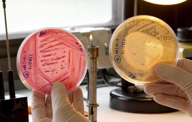 Muestras de placas Petri, sembradas con la bacteria E. Coli. A la izquierda E.Coli típico y a la derecha E. Coli atípico. EFE