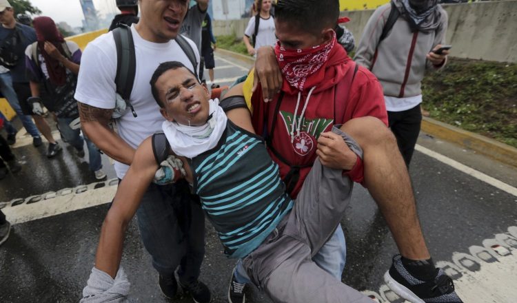Afectado por  gas lacrimógeno. /Foto AP