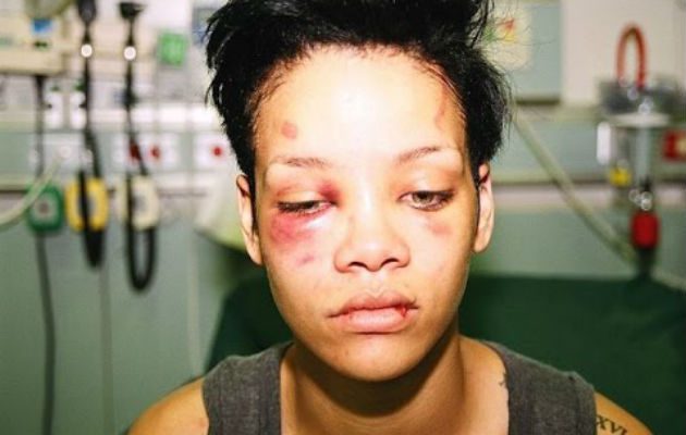 El cantante aún ama a Rihanna