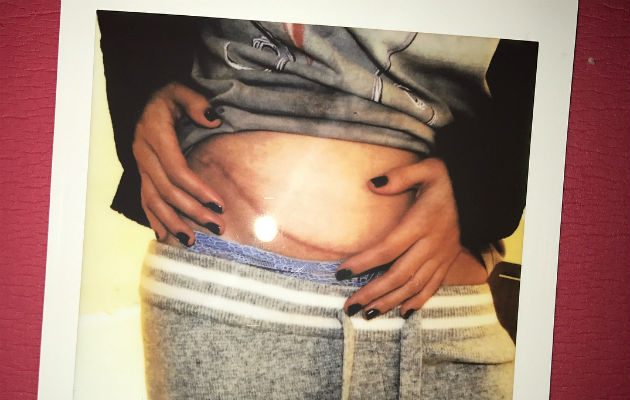 Selena está agradecida con su amiga, sus familiares y médicos