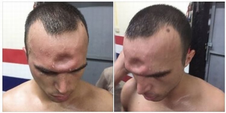 Así quedó la cabeza de Jeremy tras el golpe. Foto Facebook Jonny Betts