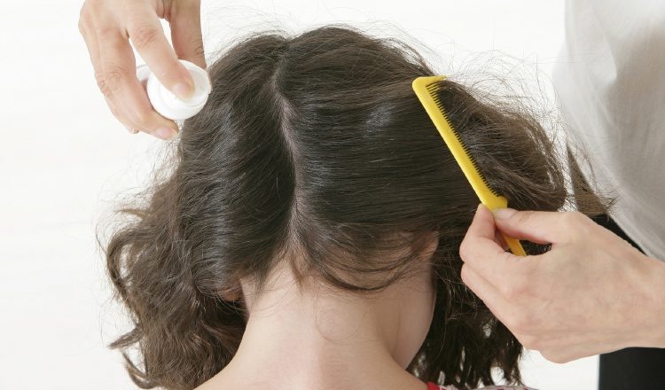 De darse un caso de piojos en un salón de clases se debe tratar a todos los niños del aula.