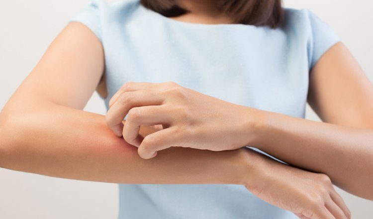 Informa al médico acerca de tus reacciones al látex y si has tenido otros signos y síntomas de alergia.