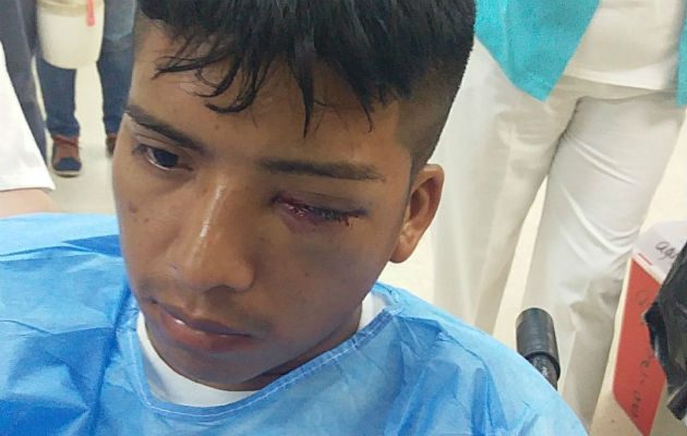 El Ministro de Seguridad, Alexis Bethancourt, se comprometió en brindar una ayuda económica a este joven. Foto: Epasa.