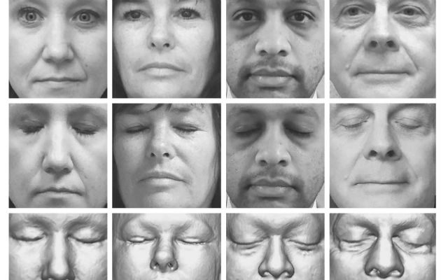 Un programa de reconocimiento facial identificó a 70 de 84 participantes en un estudio. Foto/ Mayo Clinic, via New England Journal of Medicine.