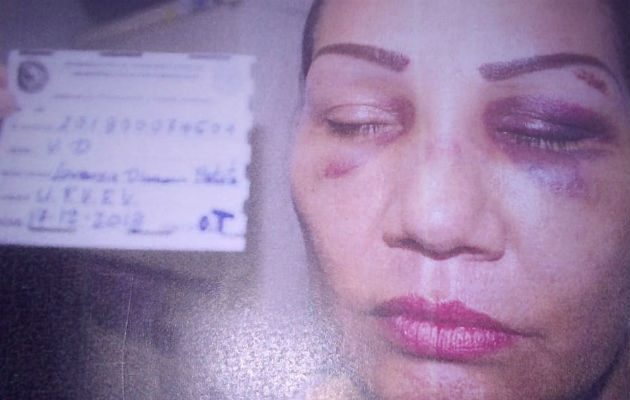 Lorenza Batista asegura que ha sufrido maltrato por su expareja. Foto: Melquíades Vásquez.