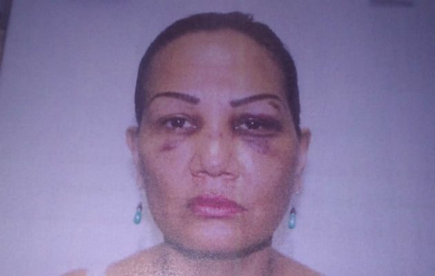 Lorenza Batista asegura que ha sufrido maltrato por su expareja. Foto: Melquíades Vásquez.