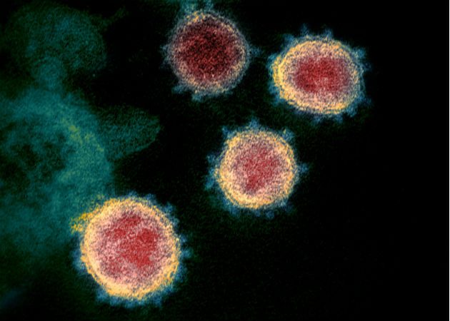 Una imagen microscópica del virus que causa el COVID-19. Foto:AP.